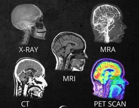 radiografie, RMN, CT, PET